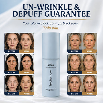 Tryviralnow - Korean Under Eye Balm