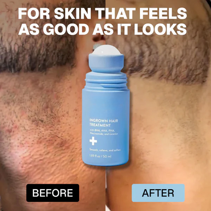 Traviralnow: Smoothing Solution For Ingrown Hairs