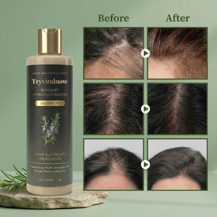 Tryviralnow™ Growth-Support Shampoo - 2-Pack