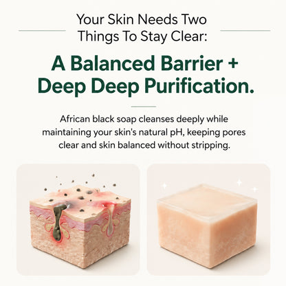 Pure Nilotica Shea Butter by Tryviralnow™