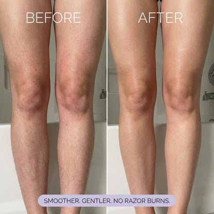 Tryviralnow Hair Removal Mousse
