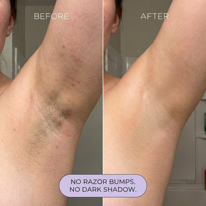 Tryviralnow Hair Removal Mousse